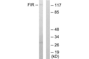 Western blot analysis of extracts from HuvEc cells, using FIR antibody. (FARP2 Antikörper  (Internal Region))