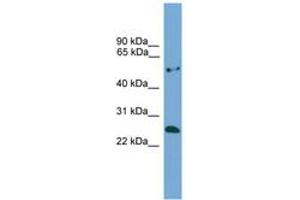 Image no. 1 for anti-Ethylmalonic Encephalopathy 1 (ETHE1) (AA 92-141) antibody (ABIN6745499) (ETHE1 Antikörper  (AA 92-141))