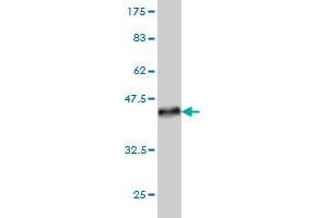 Western Blot detection against Immunogen (36. (LIM Domain Kinase 1 Antikörper  (AA 548-647))
