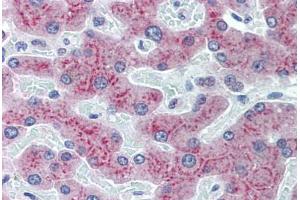 Human Liver: Formalin-Fixed, Paraffin-Embedded (FFPE) (RBP4 Antikörper  (AA 19-202))