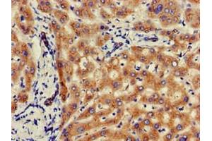 Immunohistochemistry (IHC) image for anti-Galactosidase, beta 1 (GLB1) (AA 317-455) antibody (ABIN7145493)