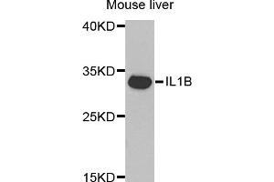 Western blot analysis of extracts of mouse liver, using IL1B antibody (ABIN5970463) at 1/1000 dilution. (IL-1 beta Antikörper)