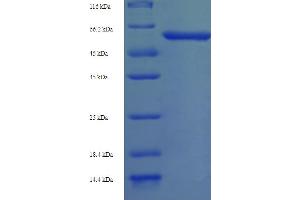 Protein Abscisic Acid-Insensitive 5 (ABI5) (AA 1-442), (full length) protein (His-SUMO Tag)
