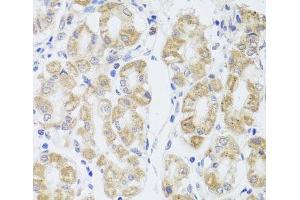 Immunohistochemistry of paraffin-embedded Human stomach using MIP Polyclonal Antibody at dilution of 1:100 (40x lens). (Mip Antikörper)