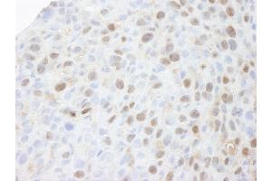 Immunohistochemistry (IHC) image for anti-Minichromosome Maintenance Complex Component 3 (MCM3) (AA 500-550) antibody (ABIN7448652)