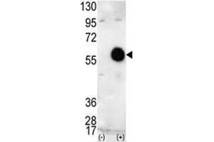 Western blot analysis of AKT2 antibody and 293 cell lysate (2 ug/lane) either nontransfected (Lane 1) or transiently transfected with the human gene (2). (AKT2 Antikörper  (AA 416-444))