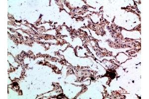 Immunohistochemical analysis of paraffin-embedded human-lung, antibody was diluted at 1:200.