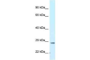 Western Blot showing Tmem106b antibody used at a concentration of 1. (TMEM106B Antikörper  (C-Term))