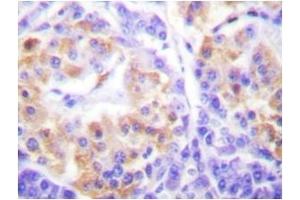 Image no. 1 for anti-Collagen, Type III, alpha 1 (COL3A1) (Chain alpha 1) antibody (ABIN272016)