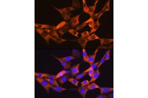 Immunofluorescence analysis of NIH-3T3 cells using F Rabbit mAb (ABIN7267150) at dilution of 1:100 (40x lens). (FABP1 Antikörper)