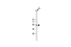 Anti-OTUD3 Antibody (Center) at 1:2000 dilution + Caco2 whole cell lysate Lysates/proteins at 20 μg per lane.