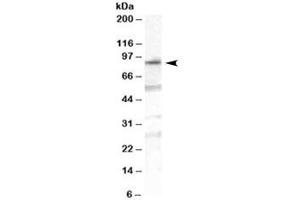 Western blot testing of human duodenum lysate with OSBPL10 antibody at 1ug/ml. (OSBPL10 Antikörper)