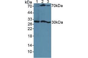 Figure. (PSG1 Antikörper  (AA 202-401))