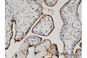 Immunoperoxidase of monoclonal antibody to CLIC5 on formalin-fixed paraffin-embedded human placenta. (CLIC5 Antikörper  (AA 91-190))