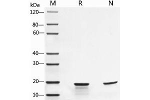 2 μg of IL-1β, Mouse was resolved with SDS-PAGE under reducing (R) and non-reducing (N) conditions and visualized by Coomassie Blue staining. (IL-1 beta Protein)
