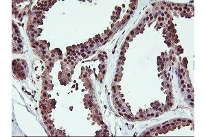 Immunohistochemical staining of paraffin-embedded Human breast tissue using anti-SAMHD1 mouse monoclonal antibody. (SAMHD1 Antikörper)