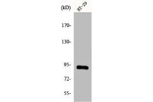 Western Blot analysis of Jurkat cells using CAGE-1 Polyclonal Antibody (CAGE1 Antikörper  (C-Term))