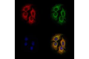 ABIN6258435 and ABIN6275055 staining Hela cells by IF/ICC.