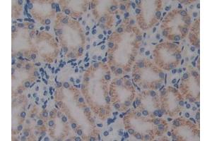 DAB staining on IHC-P; Samples: Mouse Kidney Tissue (PTX3 Antikörper  (AA 183-381))