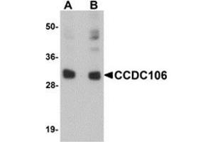 Western blot analysis of CCDC106 in human brain tissue lysate with CCDC106 antibody at (A) 0.