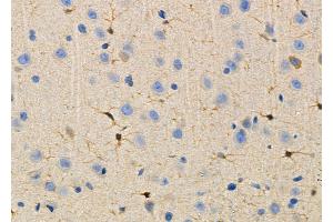 ABIN6264678 and ABIN6266629 at 1/100 staining Rat brain tissue by IHC-P.