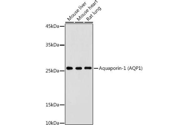Aquaporin 1 Antikörper  (C-Term)