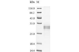(Tris-Glycine gel) Discontinuous SDS-PAGE (reduced) with 5 % enrichment gel and 15 % separation gel.