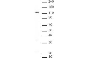 SIRT1 mAb (Clone 2G1/F7) tested by Western blot. (SIRT1 Antikörper  (AA 581-630))