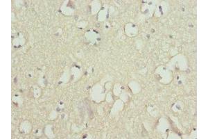 Immunohistochemistry of paraffin-embedded human brain tissue using ABIN7170056 at dilution of 1:100 (FXYD2 Antikörper  (AA 1-64))