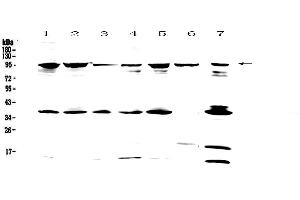 Western blot analysis of FES using anti-FES antibody .