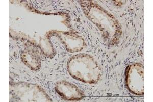 Image no. 1 for anti-Interferon Regulatory Factor 9 (IRF9) (AA 1-394) antibody (ABIN599132) (IRF9 Antikörper  (AA 1-394))