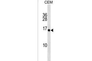 PLGLA Antibody (N-term) (ABIN1539205 and ABIN2850410) western blot analysis in CEM cell line lysates (35 μg/lane). (PLGLA Antikörper  (N-Term))