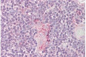 Anti-LYN antibody IHC staining of human thymus. (LYN Antikörper  (AA 39-58))