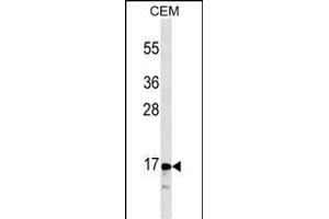 CALCA/CT Antibody (ABIN1536609 and ABIN2843838) western blot analysis in CEM cell line lysates (35 μg/lane). (Calcitonin Antikörper  (AA 56-84))