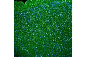 anti-Synaptophysin (SYP) (N-Term) antibody