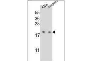 LSM7 Antibody (C-term) (ABIN655625 and ABIN2845104) western blot analysis in CEM cell line and mouse spleen tissue lysates (35 μg/lane). (LSM7 Antikörper  (C-Term))