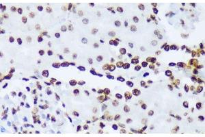 Immunohistochemistry of paraffin-embedded Rat kidney using Phospho-ABL1(Y245) Polyclonal Antibody at dilution of 1:100 (40x lens). (ABL1 Antikörper  (pTyr245))