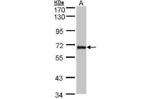 WB Image Sample (30 ug of whole cell lysate) A: MOLT4 , 7. (DENND1B Antikörper  (Center))