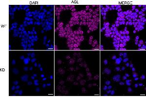 Immunocytochemical staining of HeLa cells using AGL antibody (ABIN7797592), 1:1,000), Top panel: wild-type (WT), Bottom panal: AGL shRNA knockdown (KD).