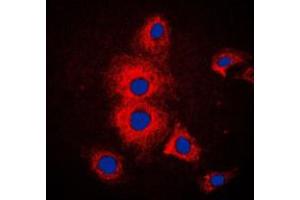 Immunofluorescent analysis of Cytokeratin 19 staining in MCF7 cells. (Cytokeratin 19 Antikörper  (Center))