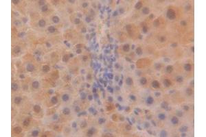 DAB staining on IHC-P; Samples: Rat Liver Tissue (SOD1 Antikörper  (AA 2-154))