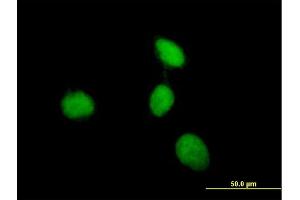 Immunofluorescence of purified MaxPab antibody to MEN1 on HeLa cell.