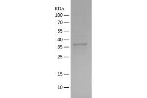 Western Blotting (WB) image for Afamin (AFM) (AA 22-143) protein (His-IF2DI Tag) (ABIN7121754)