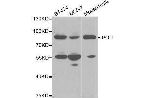 Western blot analysis of extracts of various cell lines, using POLI antibody. (POLI Antikörper  (AA 50-350))