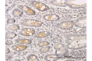 Immunoperoxidase of monoclonal antibody to RIN2 on formalin-fixed paraffin-embedded human small Intestine. (RIN2 Antikörper  (AA 786-894))