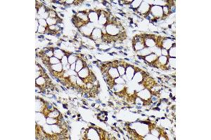 Immunohistochemistry of paraffin-embedded human colon using p70 S6 Kinase 2 Rabbit mAb (ABIN7270034) at dilution of 1:100 (40x lens). (RPS6KB2 Antikörper)