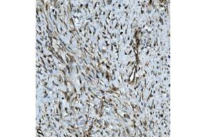 IHC analysis of MMP2 using anti-MMP2 antibody (ABIN7601677). (MMP2 Antikörper  (AA 411-660))