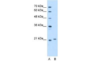 TCAP antibody used at 5 ug/ml to detect target protein. (TCAP Antikörper)