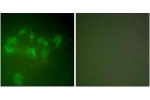 Immunofluorescence (IF) image for anti-Mdm2, p53 E3 Ubiquitin Protein Ligase Homolog (Mouse) (MDM2) (AA 391-440) antibody (ABIN2889224) (MDM2 Antikörper  (AA 391-440))