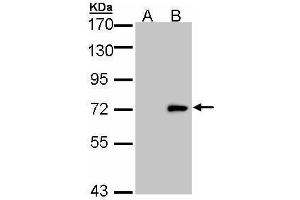 WB Image Western Blot analysis of ULK4 expression in transfected 293T cell line by ULK4 polyclonal antibody. (ULK4 Antikörper  (Internal Region))